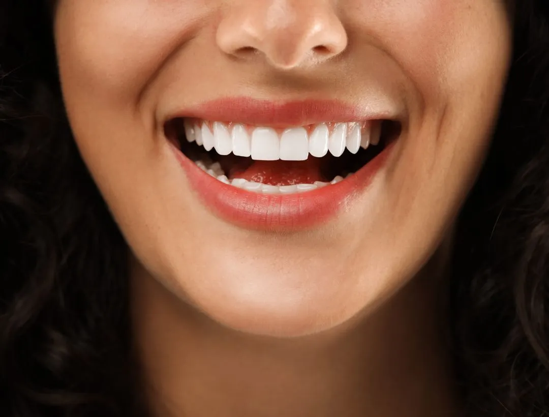 what factors impact dental implant success?