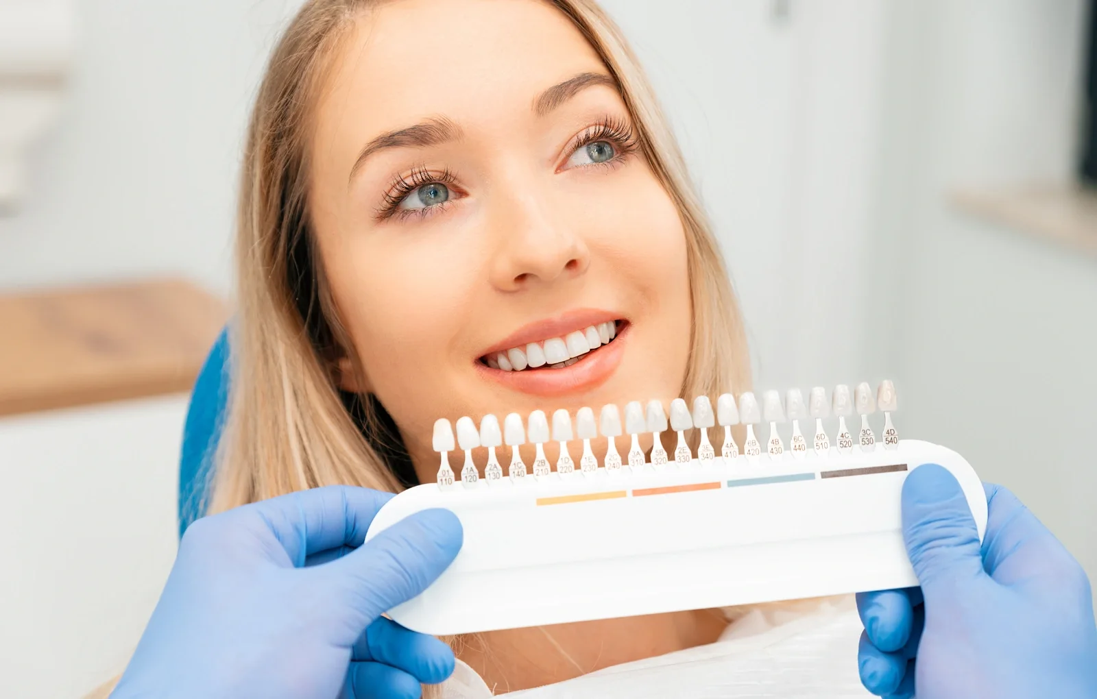 veneers