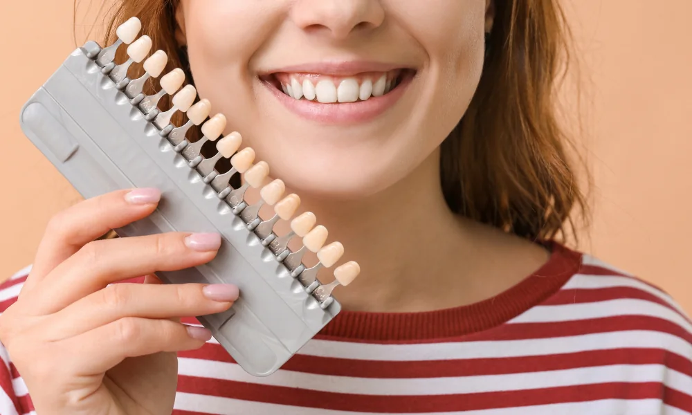porcelain veneers shade guide for smile makeover cost in san diego ca
