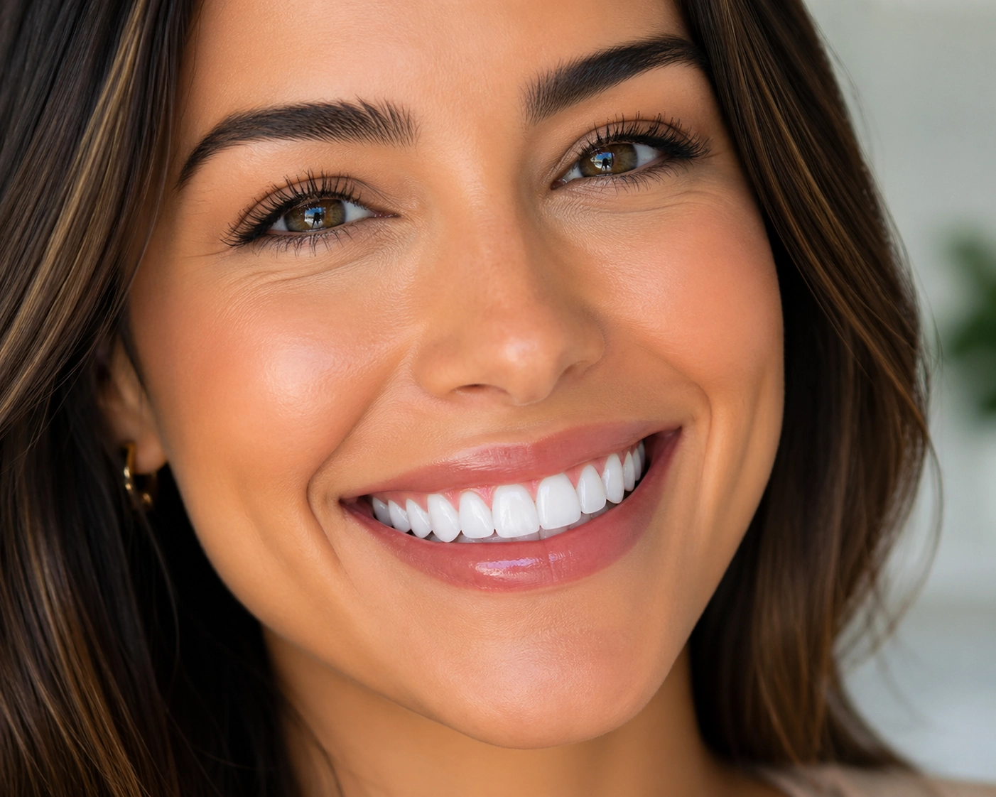 invisalign or veneers