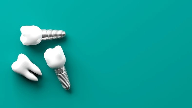 top rated implants